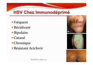 HSV Chez Immunodéprimé
Fréquent
Récidivant
BipolaireBipolaire
Cutané
Chronique
Résistant Aciclovir
MOUFFOK N, herpes virus
 