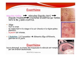Exanthème
macules rosées vésicules (liquide clair)
(liquide trouble) croutelles brunâtres qui tombe
vers le 8e j sans cicatrice.
Siège :
- tout le corps
- ne respectant ni le visage ni le cuir chevelu ni la région palmo-- ne respectant ni le visage ni le cuir chevelu ni la région palmo-
plantaire ,
- le prurit est intense.
L’évolution: 1 à 3 poussées = éléments d’âge différents,
guérison en 10 jours.
Enanthème
bucco pharyngé, au niveau des muqueuses la vésicule est remplacée
par une érosion douloureuse.
MOUFFOK N, herpes virus
 