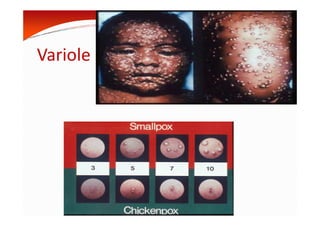Variole
MOUFFOK N, herpes virus
 