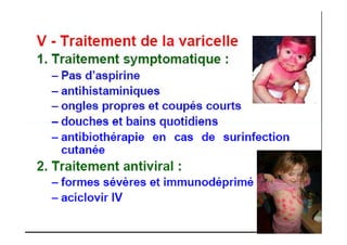 MOUFFOK N, herpes virus
 