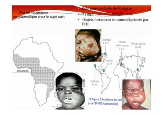 Pas de récurrence
symptomatique chez le sujet sain
Rôle dans maladie de Hodgkin
•Lymphomes non hodgkiniens
–Sujets fortement immunodéprimés par
VIH
MOUFFOK N, herpes virus
Lymphome
de Burkitt
 