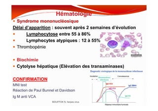 Hématologie
Syndrome mononucléosique
Délai d’apparition : souvent après 2 semaines d’évolution
Lymphocytose entre 55 à 86%
Lymphocytes atypiques : 12 à 55%
Thrombopénie
Biochimie
Cytolyse hépatique (Elévation des transaminases)
CONFIRMATION
MNI test
Réaction de Paul Bunnel et Davidson
Ig M anti VCA
MOUFFOK N, herpes virus
 