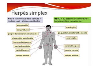 Herpès simplex
HSV-1 « au-dessus de la ceinture »:
oculaire, oral, atteintes cérébrales
HSV-2 « au-dessous de la ceinture »:
herpès génitaux, nouveau-né
MOUFFOK N, herpes virus
 