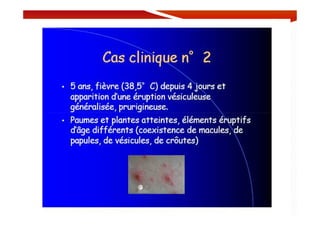 MOUFFOK N, herpes virus
 