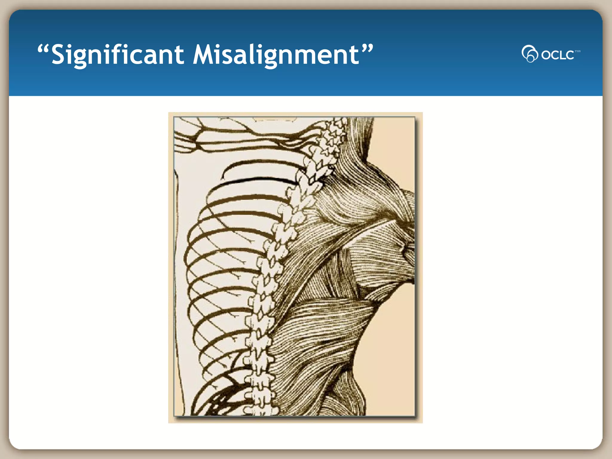 “Significant Misalignment” 