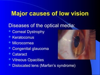 Major causes of low vision
Diseases of the optical media:
 Corneal Dystrophy
 Keratoconus
 Microcornea
 Congenital glaucoma
 Cataract
 Vitreous Opacities
 Dislocated lens (Marfan’s syndrome)
 
