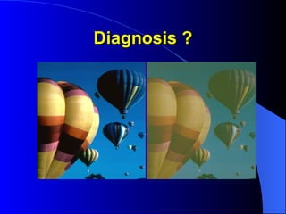 Diagnosis ?
Diagnosis ?
 