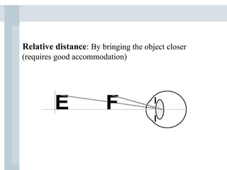 Relative distance: By bringing the object closer
(requires good accommodation)
 