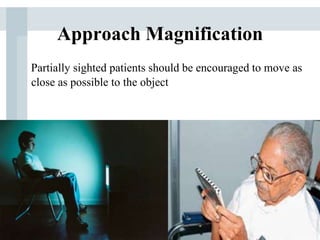 Approach Magnification
Partially sighted patients should be encouraged to move as
close as possible to the object
 