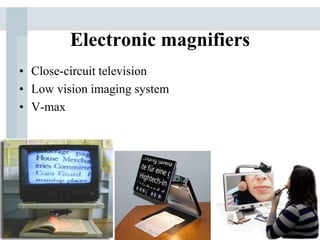 Electronic magnifiers
• Close-circuit television
• Low vision imaging system
• V-max
 