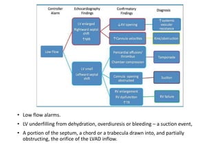 • Low flow alarms.
• LV underfilling from dehydration, overdiuresis or bleeding – a suction event,
• A portion of the septum, a chord or a trabecula drawn into, and partially
obstructing, the orifice of the LVAD inflow.
 
