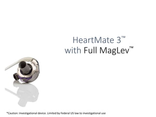 HeartMate 3™
with Full MagLev™
Designed with a Healthy Respect for the Blood
*Caution: Investigational device. Limited by Federal US law to investigational use
 