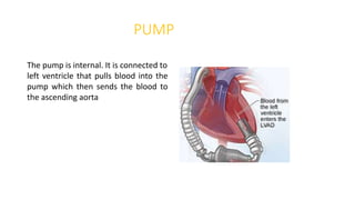 PUMP
The pump is internal. It is connected to
left ventricle that pulls blood into the
pump which then sends the blood to
the ascending aorta
 