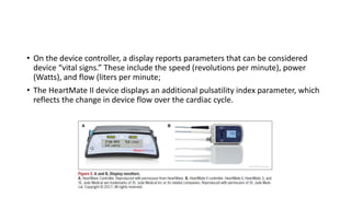 • On the device controller, a display reports parameters that can be considered
device “vital signs.” These include the speed (revolutions per minute), power
(Watts), and flow (liters per minute;
• The HeartMate II device displays an additional pulsatility index parameter, which
reflects the change in device flow over the cardiac cycle.
 