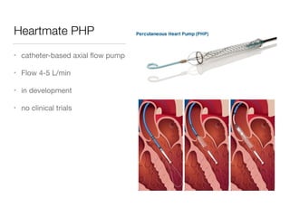 Heartmate PHP
• catheter-based axial ﬂow pump

• Flow 4-5 L/min

• in development

• no clinical trials
 