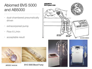 Abiomed BVS 5000
and AB5000
• dual-chambered pneumatically
driven

• extracorporeal pump

• Flow 6 L/min

• acceptable result
 