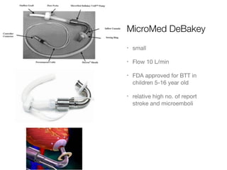 MicroMed DeBakey
• small

• Flow 10 L/min

• FDA approved for BTT in
children 5-16 year old

• relative high no. of report
stroke and microemboli
 