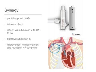 Synergy
• partial-support LVAD

• intravascularly

• inﬂow: via subclavian v. to RA
to LA

• outﬂow: subclavian a.

• improvement hemodynamics
and reduction HF symptom
 
