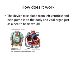 How does it work
• The device take blood from left ventricle and
help pump in to the body and vital organ just
as a health heart would.