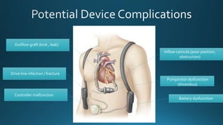 Inflow cannula (poor position,
obstruction)
Pump/rotor dysfunction
(thrombus)
Battery dysfunction
Outflow graft (kink , leak)
Drive line infection / fracture
Controller malfunction
 