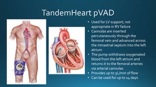 • Used for LV support; not
appropriate in RV failure
• Cannulas are inserted
percutaneously through the
femoral vein and advanced across
the intraatrial septum into the left
atrium
• The pump withdraws oxygenated
blood from the left atrium and
returns it to the femoral arteries
via arterial cannulas
• Provides up to 5L/min of flow
• Can be used for up to 14 days
 