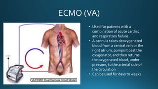 • Used for patients with a
combination of acute cardiac
and respiratory failure
• A cannula takes deoxygenated
blood from a central vein or the
right atrium, pumps it past the
oxygenator, and then returns
the oxygenated blood, under
pressure, to the arterial side of
the circulation
• Can be used for days to weeks
 