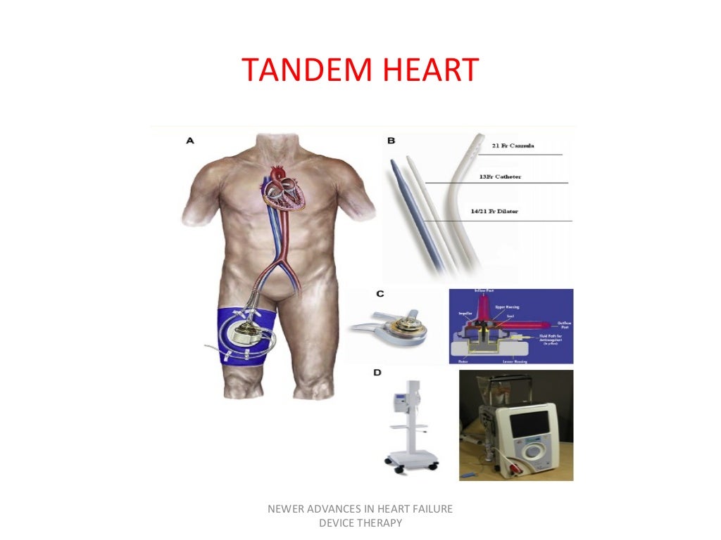 heart failure device therapy