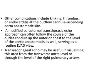 • Other complications include kinking, thrombus,
or endocarditis at the outflow cannula–ascending
aorta anastomotic site.
• A modified parasternal transthoracic echo
approach can often follow the course of the
outlet conduit up the anterior chest to the level
of the aortic anastomosis as well, serving as a
routine LVAD view.
• Transesophageal echo may be useful in visualizing
this area from the transverse aorta level or
through the level of the right pulmonary artery.
 