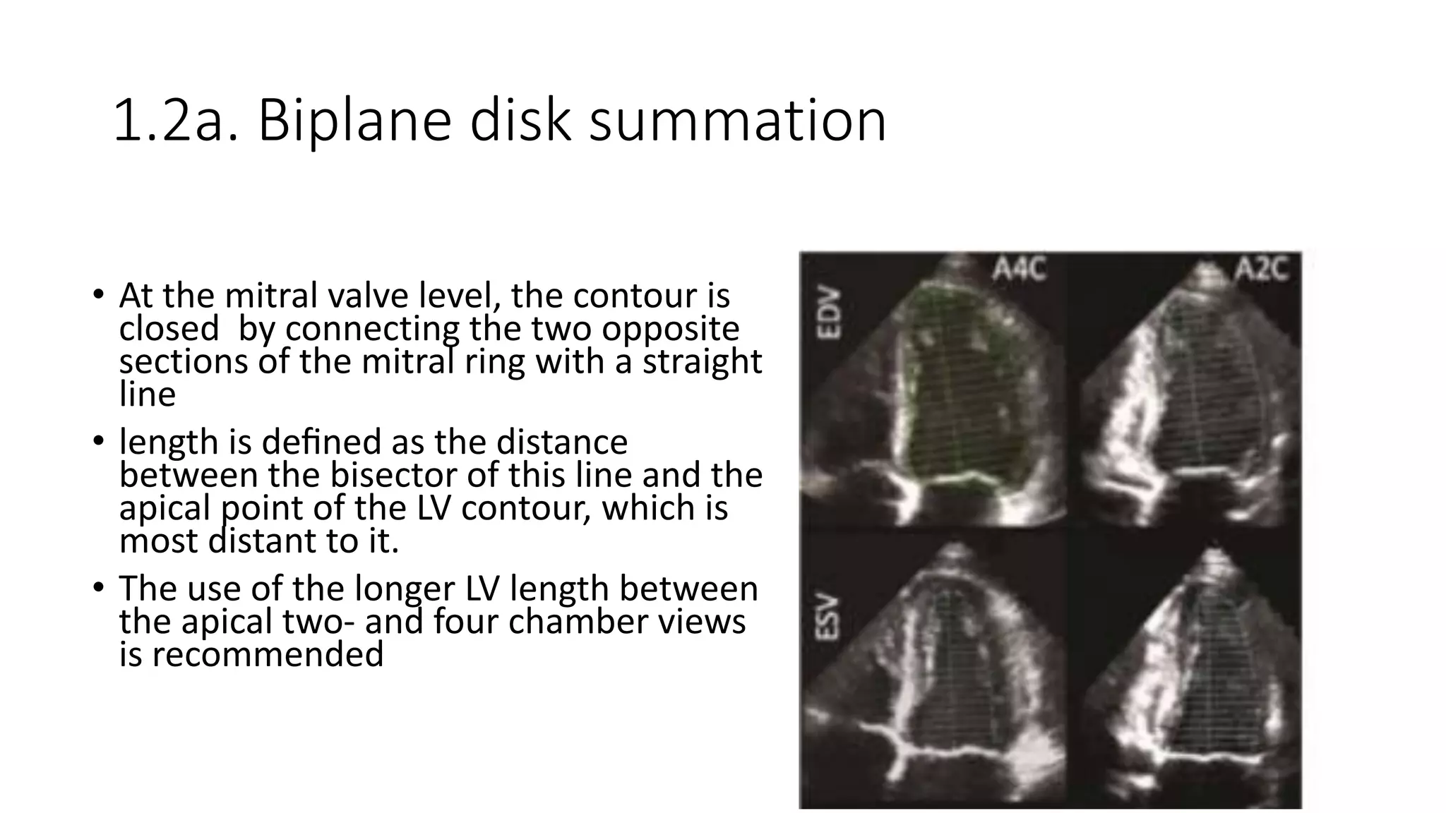 Lv chamber quantifications.2015