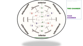 LONG AXIS
TWO CHAMBER
FOUR
CHAMBER
 