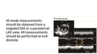M-mode measurements
should be obtained from a
targeted SAX or a parasternal
LAX view. All measurements
should be performed at end-
diastole.
 