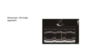 Dimension : M-mode
approach
 