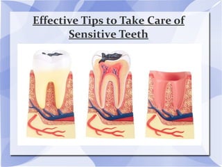 Effective Tips to Take Care of
Sensitive Teeth
 