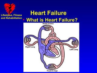 Lifestyles, Fitness      Heart Failure
and Rehabilitation
                      • What is Heart Failure?
 