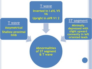 Abnormalities
of ST segment
& T wave
T wave
Assymetrical
Shallow proximal
limb
T wave
Inverted in I aVL V5
V6
Upright in aVR V1 2
ST segment
Minimally
depressed with
slight upward
convexity in left
oriented leads
 