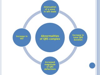 Abnormalities
of QRS complex
Attenuation
of q wave
in left leads
Increase in
total QRS
duration
Increased
magnitude
of QRS
deflections
Increase in
VAT
 