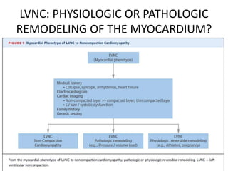 LVNC: PHYSIOLOGIC OR PATHOLOGIC
REMODELING OF THE MYOCARDIUM?
 