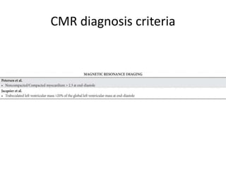 CMR diagnosis criteria
 