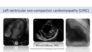 Left ventricular non-compaction cardiomyopathy (LVNC)
Ahmed ElBorae, MSc
Assistant lecturer of Cardiology, Cairo University
 