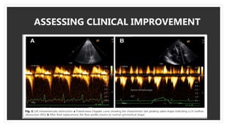 ASSESSING CLINICAL IMPROVEMENT
 