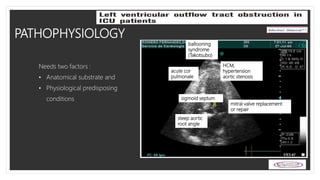 PATHOPHYSIOLOGY
HCM,
hypertension
aortic stenosis
mitral valve replacement
or repair
steep aortic
root angle
acute cor
pulmonale
ballooning
syndrome
(Takotsubo)
sigmoid septum
Needs two factors :
• Anatomical substrate and
• Physiological predisposing
conditions
 
