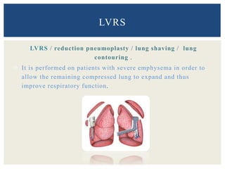 LVRS / reduction pneumoplasty / lung shaving / lung
contouring .
 It is performed on patients with severe emphysema in order to
allow the remaining compressed lung to expand and thus
improve respiratory function.
LVRS
 