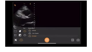 LV RV ASSESSMENT.pptx pocus ultrasound in trauma | PPTX