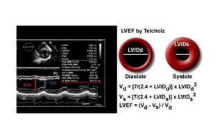 LV RV ASSESSMENT.pptx pocus ultrasound in trauma | PPTX