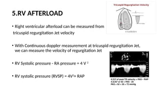 Tr Jet Rvsp LV RV ASSESSMENT.pptx pocus ultrasound in trauma | PPTX