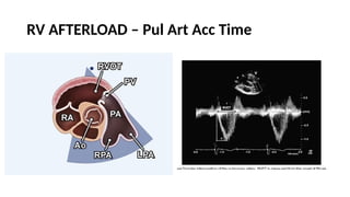LV RV ASSESSMENT.pptx pocus ultrasound in trauma | PPTX