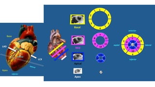 LV RV ASSESSMENT.pptx pocus ultrasound in trauma | PPTX