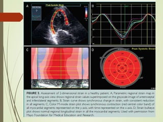 Lv systolic function | PPTX