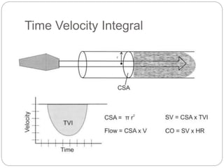 LV Systolic Function.pptx