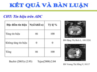 CHT: Tín hiệu trên ADC
Bachir (2003): (2.95) Tejas(2008):2.04
Đặc điểm tín hiệu N(số khối u) Tỷ lệ %
Tăng tín hiệu 46 100
Không tăng tín hiệu 0 0
Tổng 46 100
BN Đặng Thị Bích L, 10113281
BN Vương Thị Hồng V, 18117
 